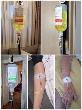 DAVANJE INFUZIJE PANCEVO